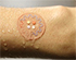 Aerosol Jet Printing of Electronics: Technology for Wearable Devices