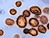 Sensor Chip Detects Disease Pathogens with 10 Times More Sensitivity